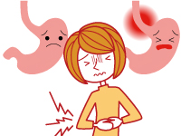 胃食道逆流症（GERD）のタイプ